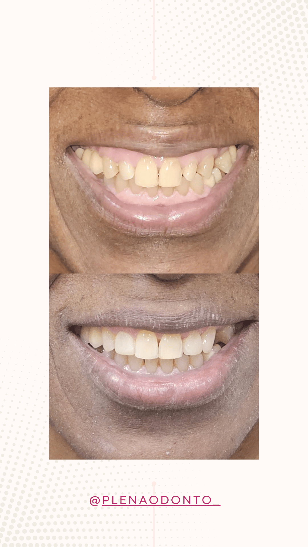 Imagens de pacientes da Plena Odontologia