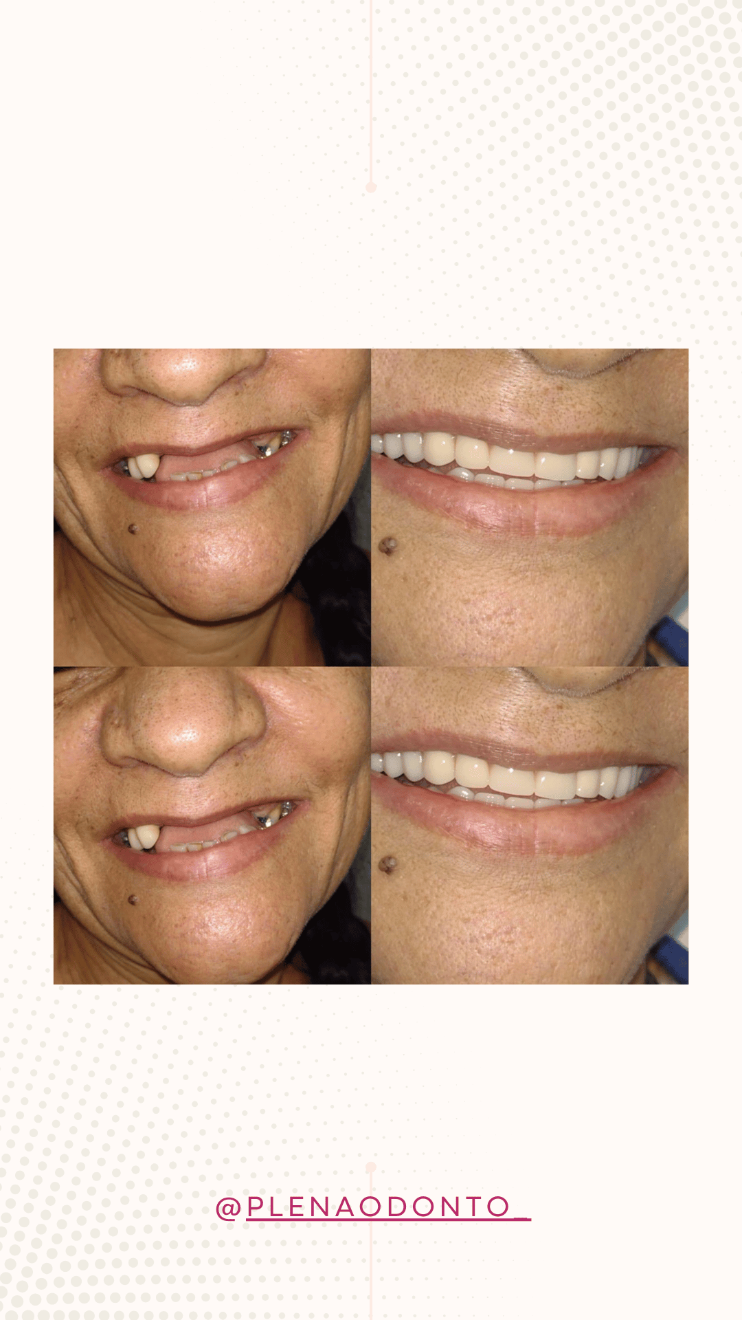 Imagens de pacientes da Plena Odontologia