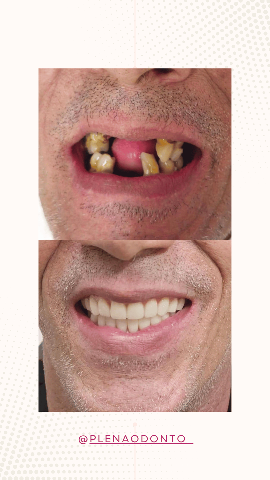 Imagens de pacientes da Plena Odontologia