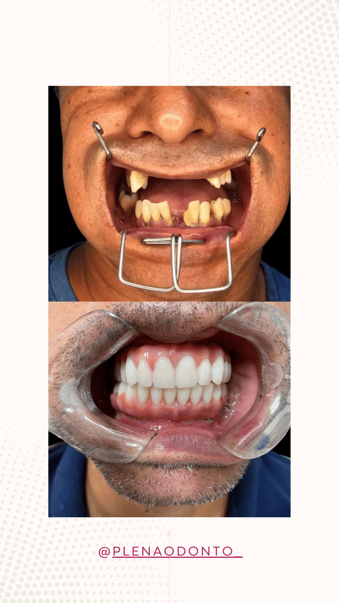 Imagens de pacientes da Plena Odontologia