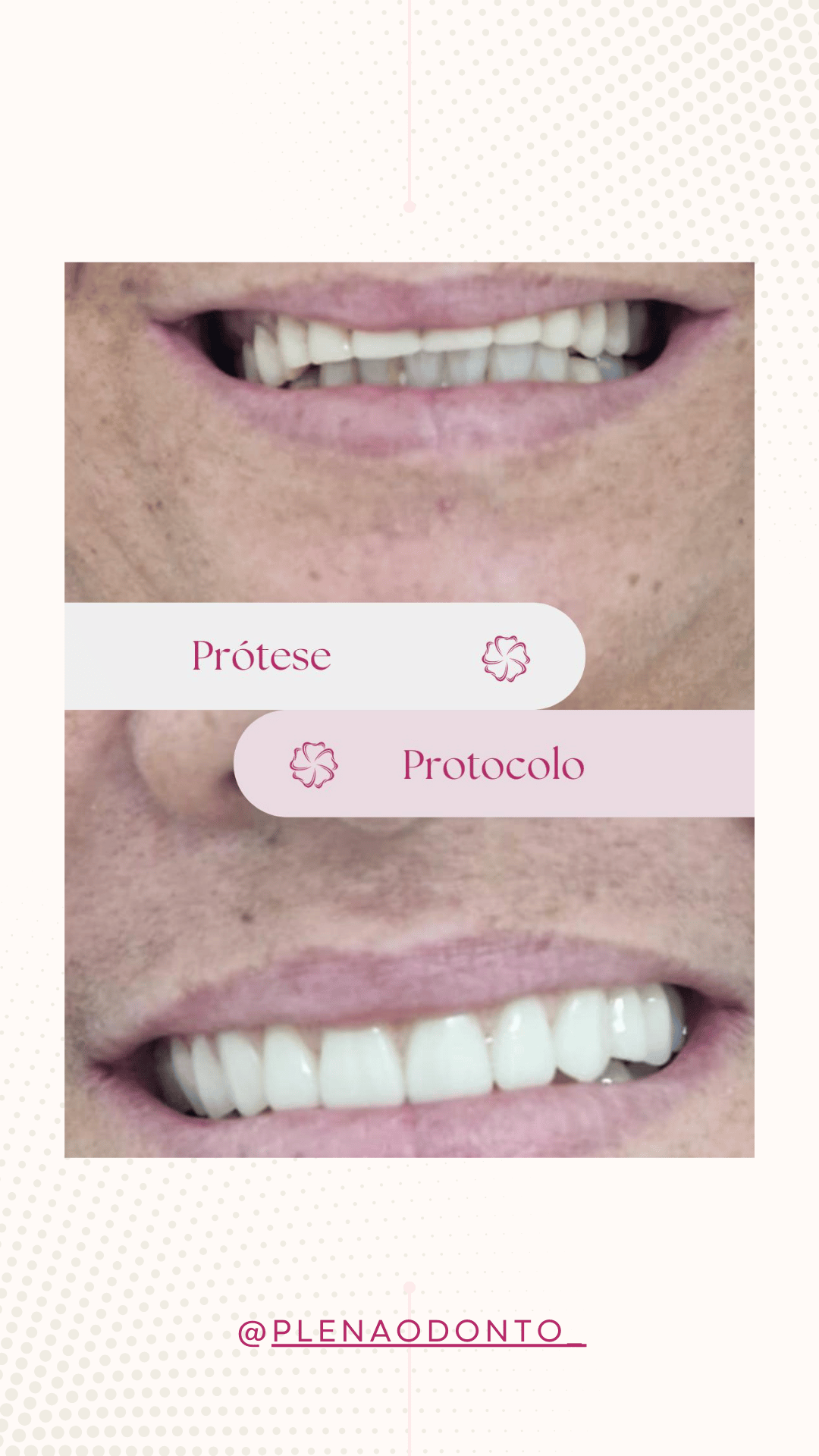 Imagens de pacientes da Plena Odontologia