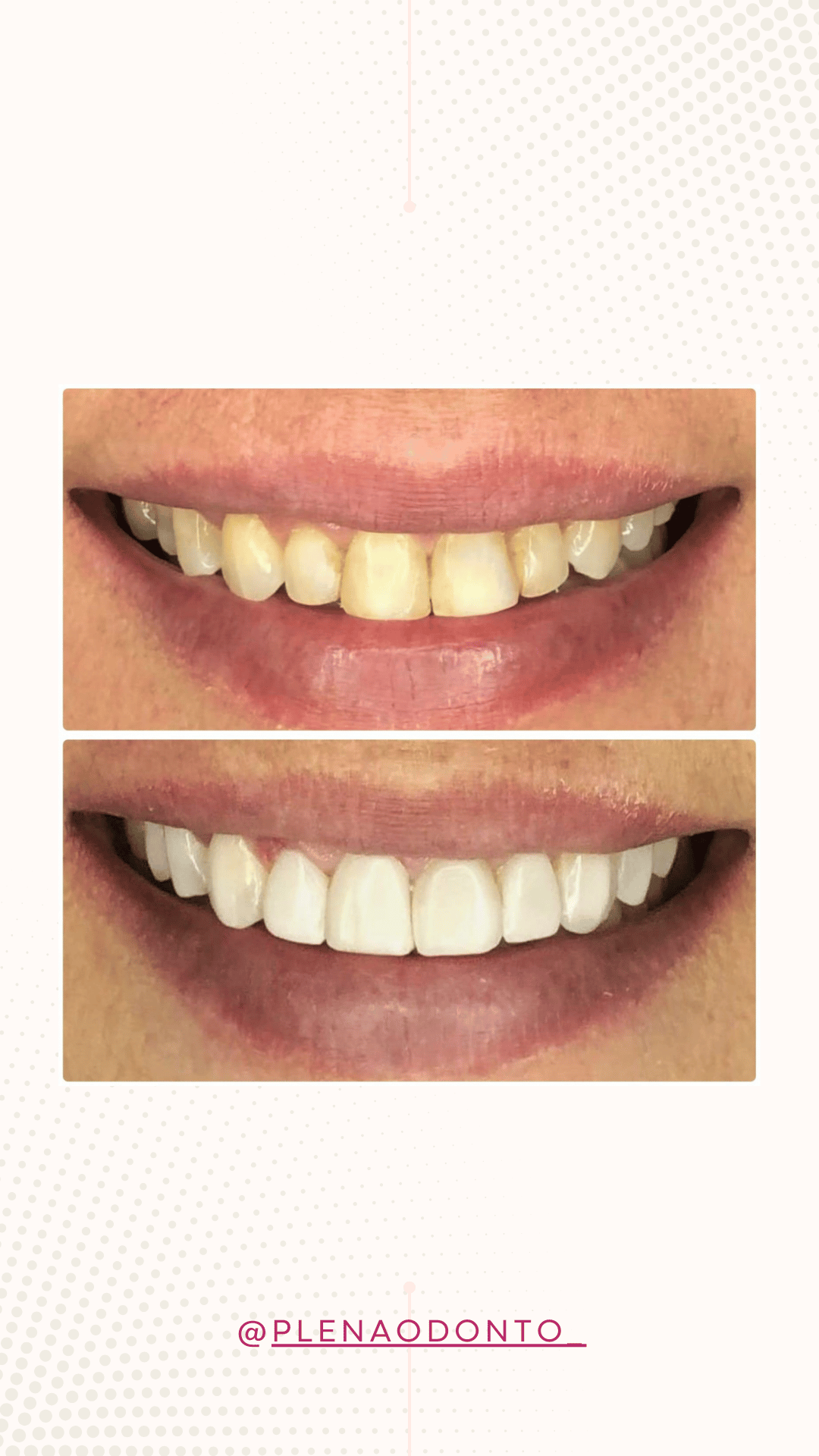 Imagens de pacientes da Plena Odontologia