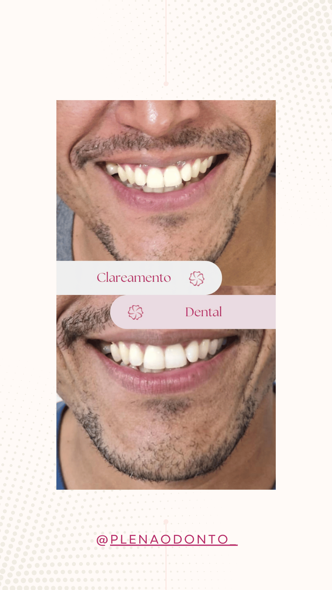 Imagens de pacientes da Plena Odontologia