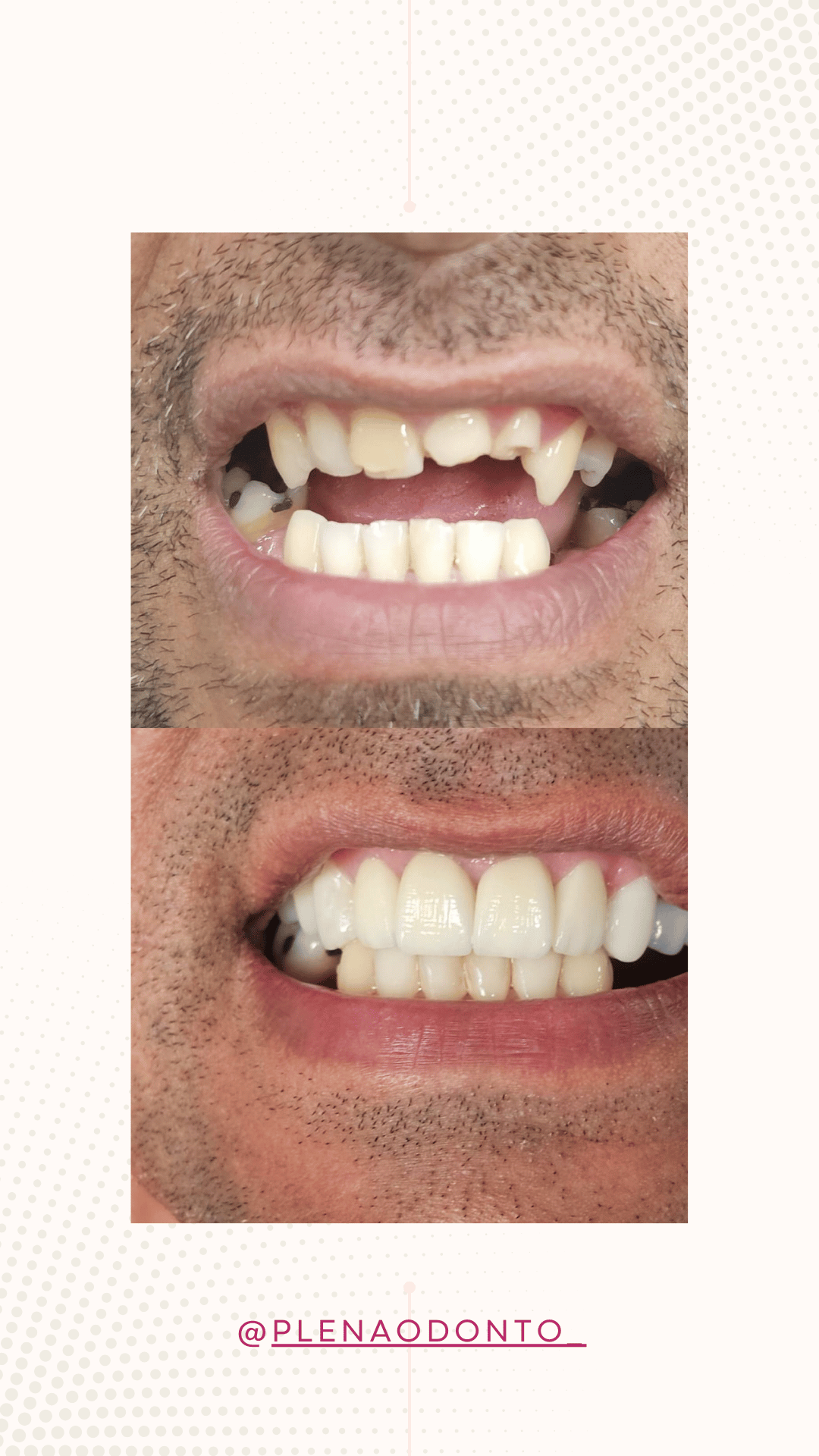 Imagens de pacientes da Plena Odontologia