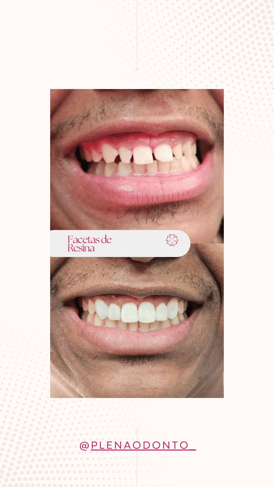 Imagens de pacientes da Plena Odontologia
