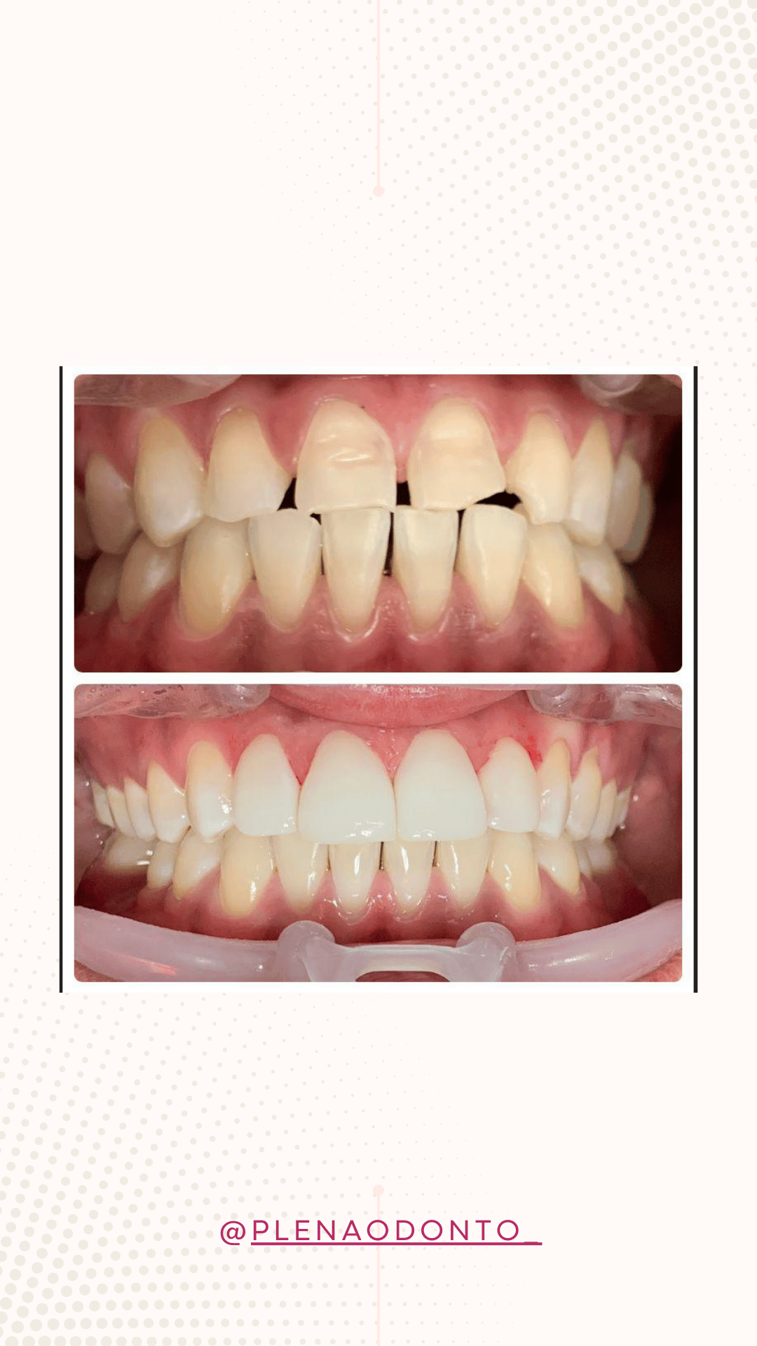 Imagens de pacientes da Plena Odontologia