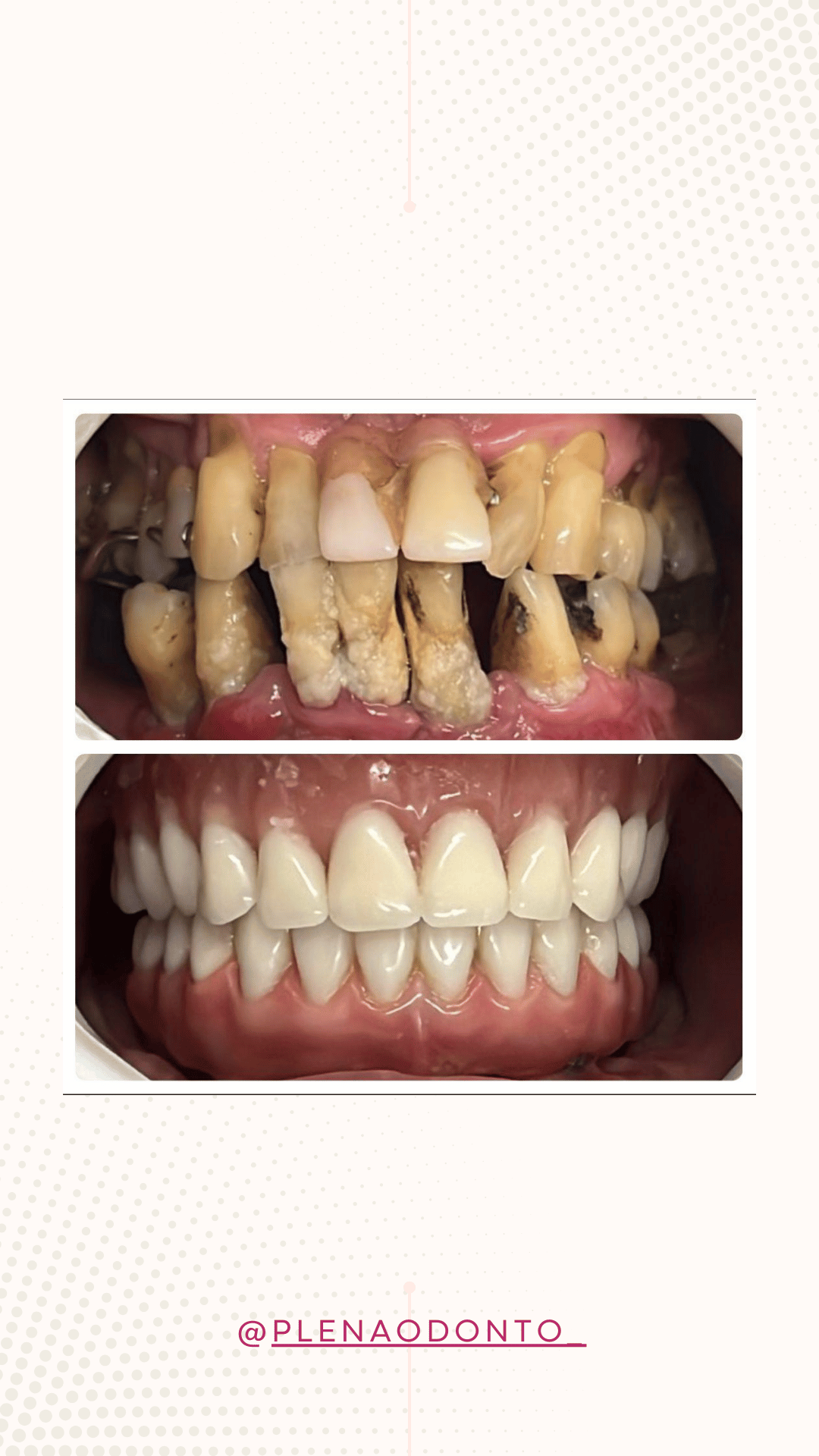 Imagens de pacientes da Plena Odontologia