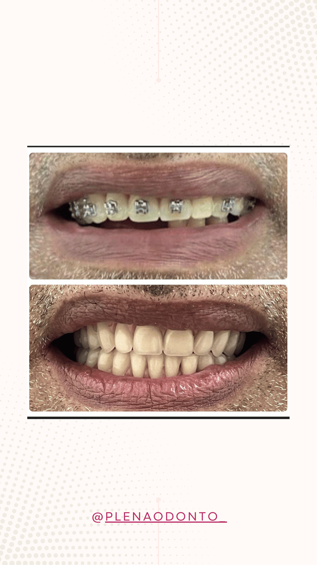 Imagens de pacientes da Plena Odontologia